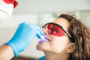 Teeth whitening dentist in chedale