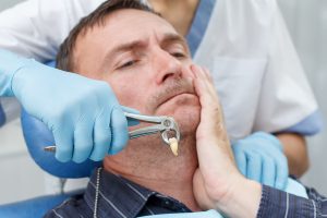 tooth extraction by dentist